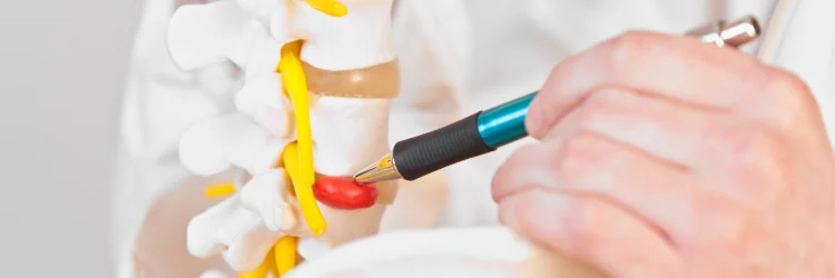 Lakeland FL Chiropractor Discusses Herniated Discs
