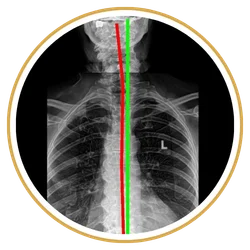 Gonstead X-rays lakeland fl